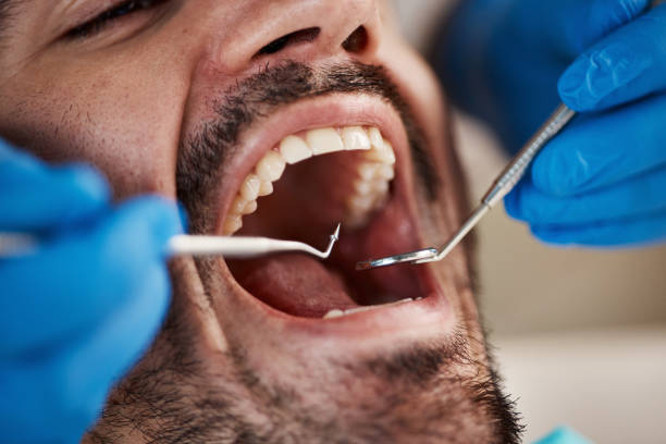 Best Tooth Pain Emergency Relief  in Live Oak, TX